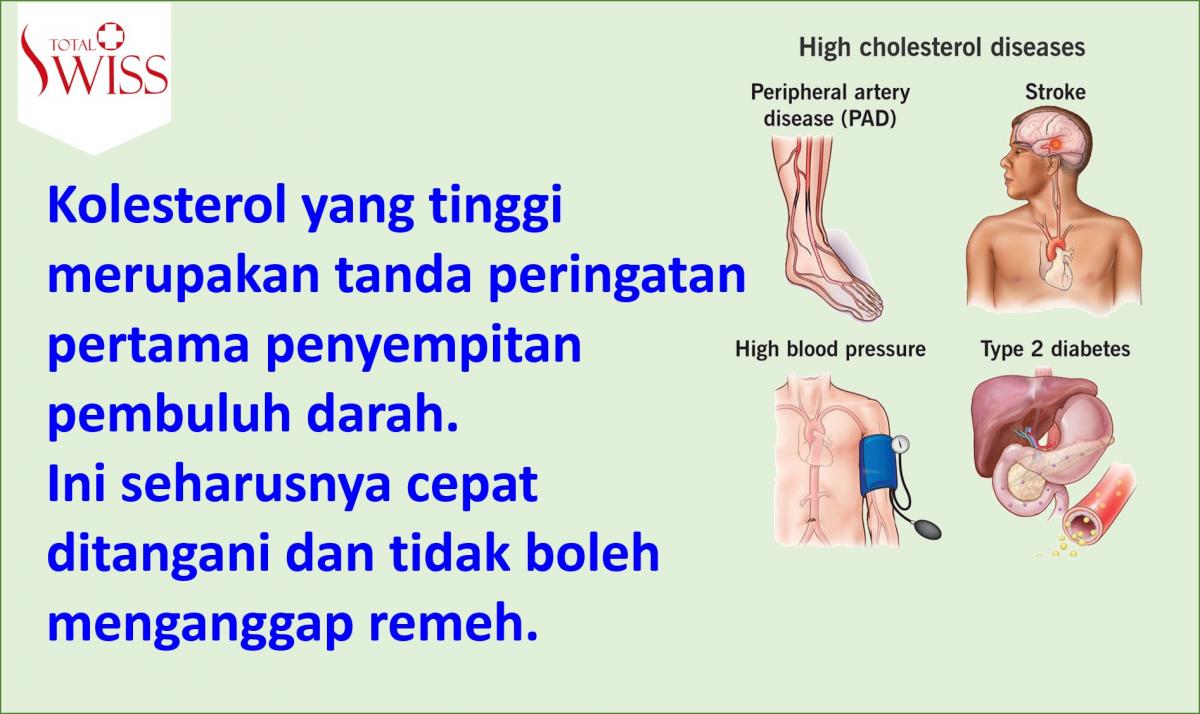 Kolesterol Merupakan Tanda Peringatan Pertama Penyakit Pembuluh Darah-2